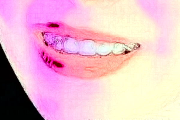 重慶醫(yī)科大學(xué)附屬口腔醫(yī)院拔智齒價目表(價格表)怎么樣