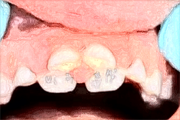 昆明總醫(yī)院牙科怎么樣?2024牙科項(xiàng)目收費(fèi)價(jià)格