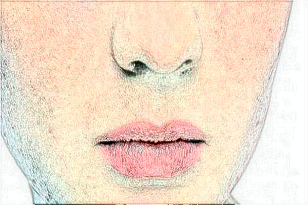 金華市中心醫(yī)院激光祛胎記做的好嗎_案例+價(jià)格