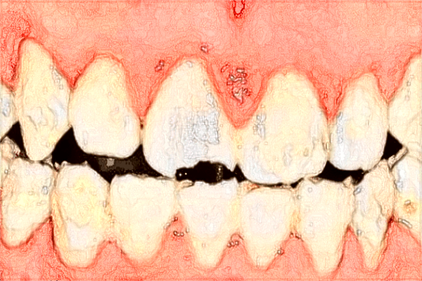青島401醫(yī)院口腔科拔牙怎么樣?2024拔牙收費(fèi)價(jià)格