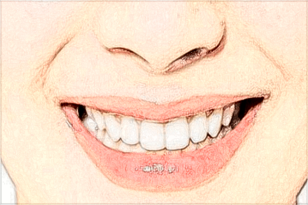 青島401醫(yī)院口腔科怎么樣?口腔科有哪些項(xiàng)目?