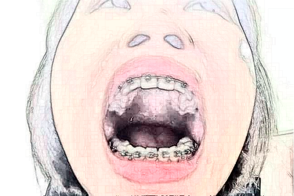 2024金華市中心醫(yī)院口腔科那個醫(yī)生好_醫(yī)生名單簡介