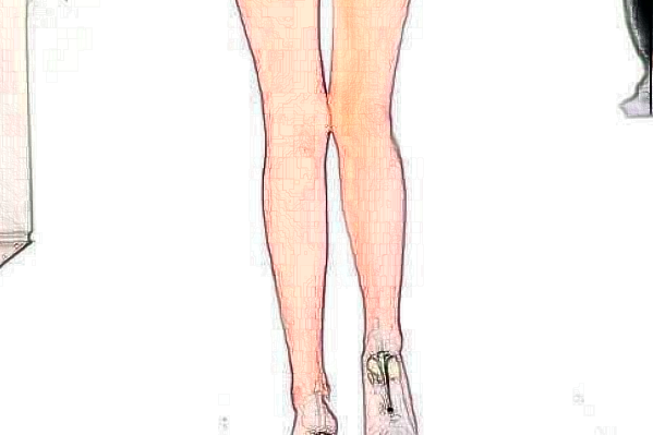 2024哈爾濱醫(yī)科大學(xué)附屬第一醫(yī)院激光脫毛做的好嗎_需要多少錢