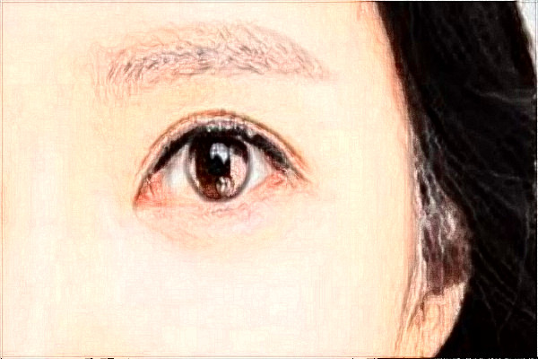 2024金華市中心醫(yī)院激光近視誰做的好?激光近視手術(shù)的后遺癥有哪些