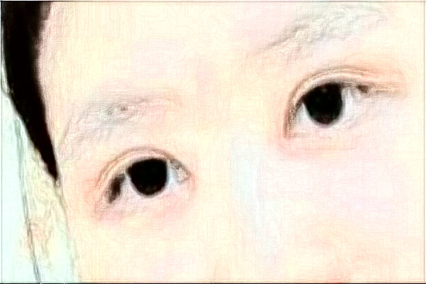 哈爾濱醫(yī)科大學附屬第一醫(yī)院全飛秒做的好嗎_需要多少錢