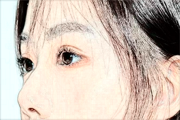 阜陽市人民醫(yī)院祛雀斑做的怎么樣_哪位醫(yī)生比較好