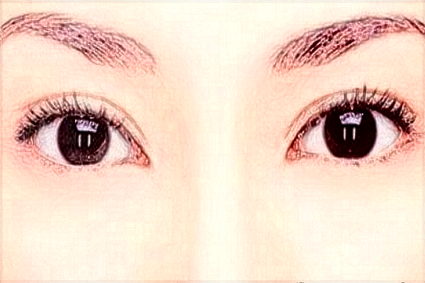 哈爾濱醫(yī)科大學(xué)附屬第一醫(yī)院近視手術(shù)做的好嗎_案例+價(jià)格