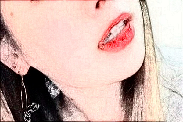 四川大學(xué)華西口腔醫(yī)院祛痣好不好_案例+價(jià)格