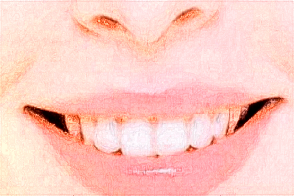 南寧市第一人民醫(yī)院口腔科醫(yī)生好嗎?2024醫(yī)生收費(fèi)價(jià)格