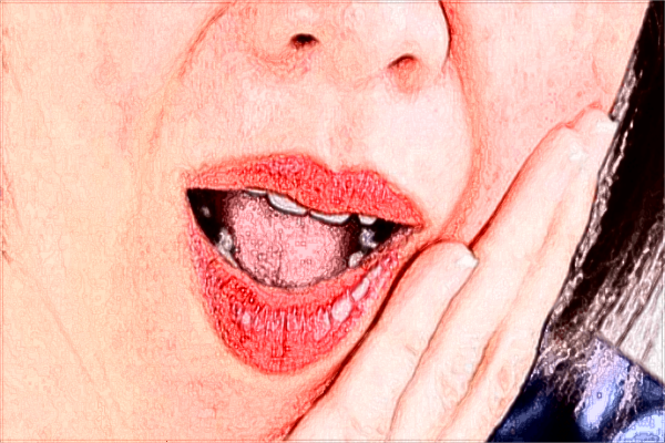 2024山東大學口腔醫(yī)院矯正牙齒多少錢?矯正牙齒痛不痛?