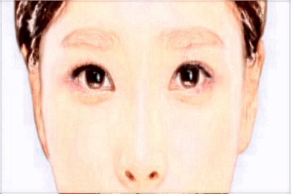 2024哈爾濱醫(yī)科大學(xué)附屬第一醫(yī)院半飛秒怎么樣_需要多少錢