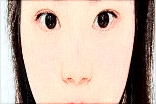 2024金華市中心醫(yī)院全飛秒做的咋樣_案例分享