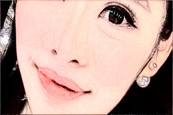 阜陽市人民醫(yī)院祛胎記做的好嗎_案例+價(jià)格