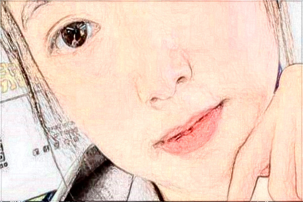 阜陽市人民醫(yī)院祛胎記做的好嗎_案例+價(jià)格