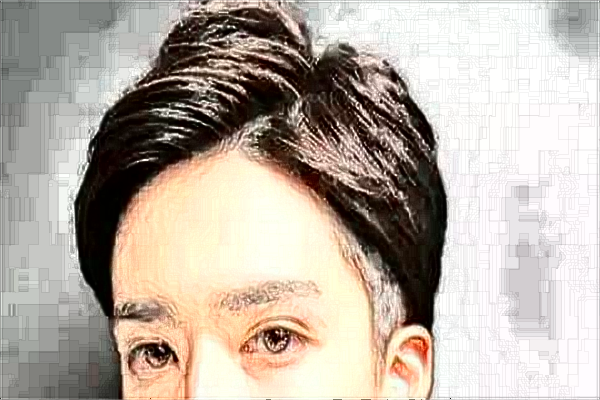 中山大學(xué)附屬第一醫(yī)院植發(fā)掛什么科?植發(fā)后注意事項