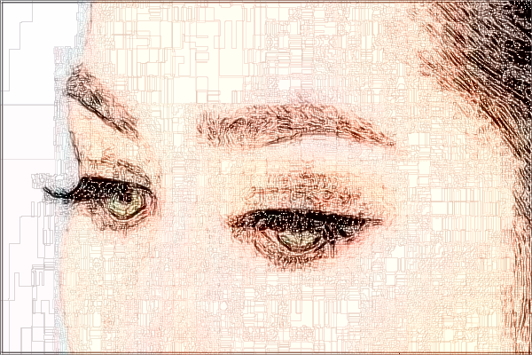 2024中山市人民醫(yī)院去眼袋多少錢?去眼袋手術(shù)恢復(fù)期多久