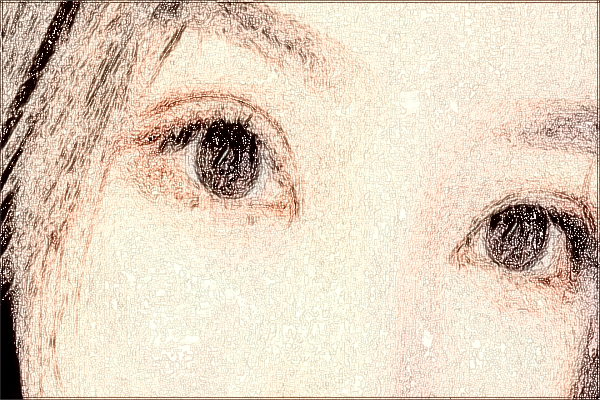 2024中山市人民醫(yī)院飛秒手術價格?飛秒手術有風險嗎