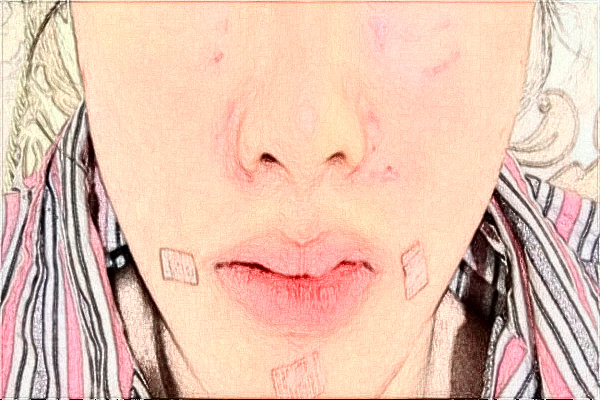 2024阜陽市人民醫(yī)院整形美容外科怎么樣？2024醫(yī)生介紹