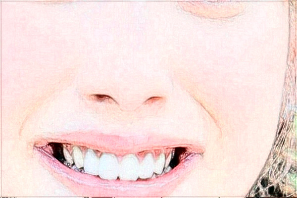 臺州醫(yī)院洗牙哪位醫(yī)生做的好_需要多少錢