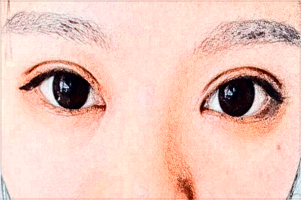 徐州市中心醫(yī)院整形美容科醫(yī)生簡介_價(jià)目表分享