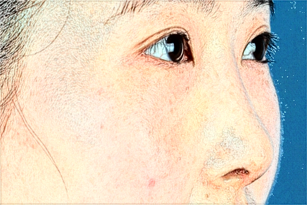 2024天津人民醫(yī)院激光祛斑怎么樣？案例價格一覽