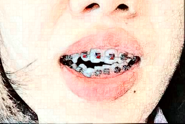 蘇州牙科醫(yī)院排行榜前五強(qiáng)揭曉!2024哪家技術(shù)好？