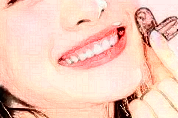 天津醫(yī)科大學(xué)口腔醫(yī)院種植牙怎么樣_醫(yī)生排名_案例