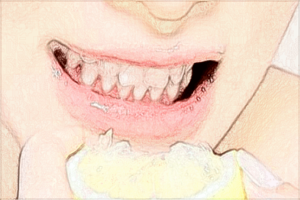 珠海市人民醫(yī)院口腔科哪個(gè)醫(yī)生好?2024收費(fèi)價(jià)格貴嗎