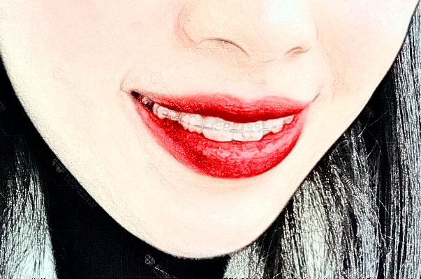 2024金華市中醫(yī)院口腔科烤瓷牙做的好嗎？哪位醫(yī)生做的好