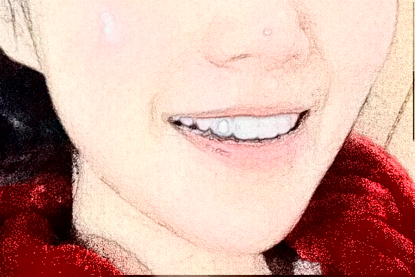 2024金華市中醫(yī)院口腔科烤瓷牙做的好嗎？哪位醫(yī)生做的好