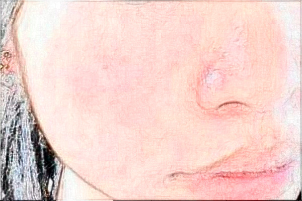 2024天津市第一中心醫(yī)院整形外科怎么樣_醫(yī)生排名公布