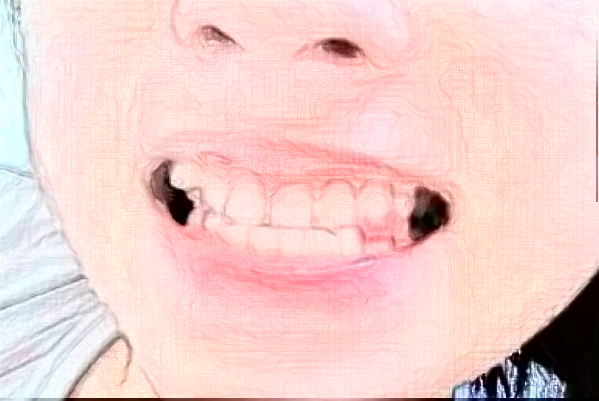 2024天津人民醫(yī)院牙科貴嗎？牙科收費(fèi)標(biāo)準(zhǔn)