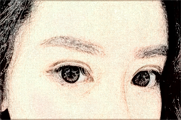 珠海市人民醫(yī)院去眼袋掛哪個(gè)醫(yī)生?去眼袋多久恢復(fù)正常