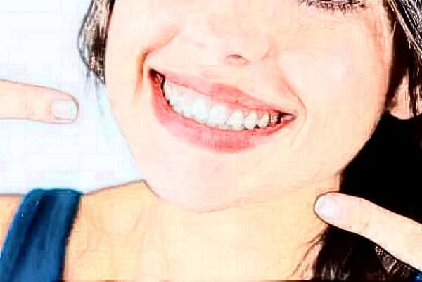 2024哈爾濱242醫(yī)院口腔科烤瓷冠做的好嗎？哪位醫(yī)生做的好