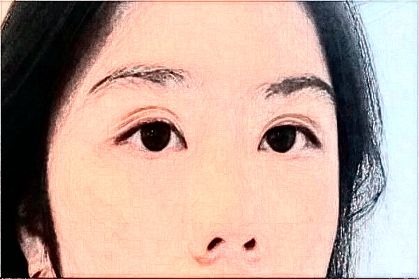 2024哈爾濱醫(yī)科大學(xué)附屬第二醫(yī)院全飛秒多少費用？醫(yī)生推薦