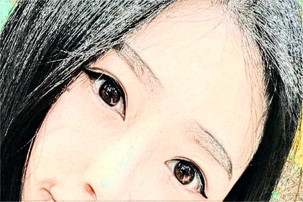 蘇州第四人民醫(yī)院激光去紅血絲多少費用？醫(yī)生排名