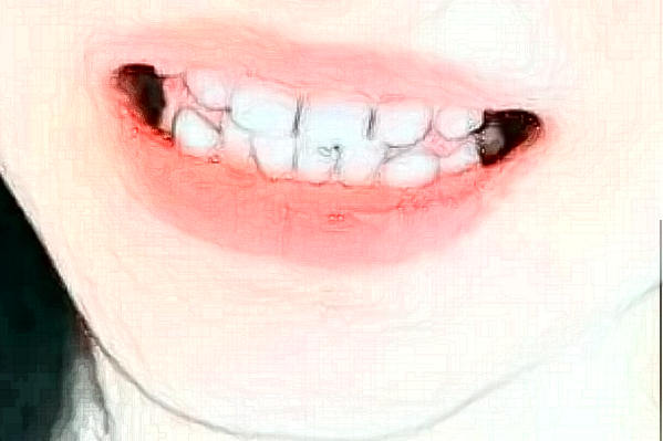 天津市口腔醫(yī)院牙冠哪個(gè)醫(yī)生好_專(zhuān)家案例