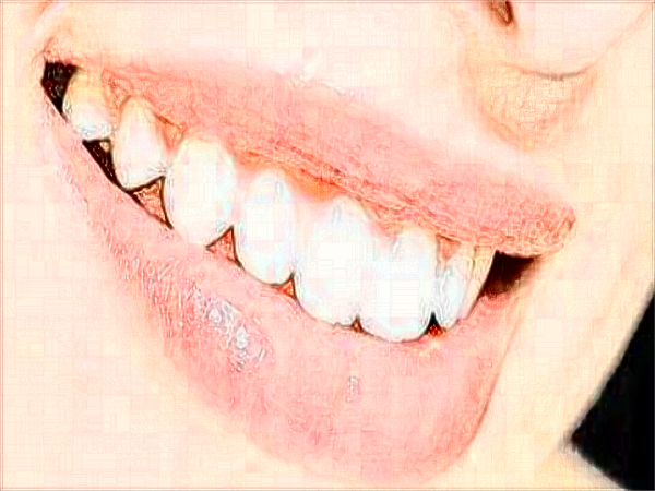 2024中山大學附屬口腔醫(yī)院洗牙多少錢?洗牙有什么好處