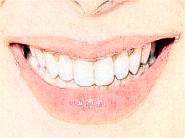 2024中山大學(xué)附屬口腔醫(yī)院洗牙收費(fèi)標(biāo)準(zhǔn)?洗牙能讓牙變白?