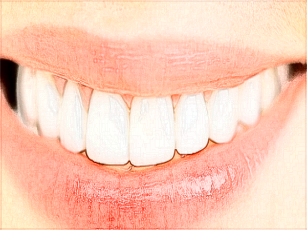 中山大學附屬口腔醫(yī)院洗牙掛什么科?洗牙好不好?