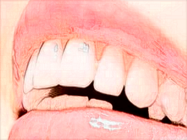 中山大學(xué)附屬口腔醫(yī)院口腔正畸科的范圍?2024正畸科價(jià)格