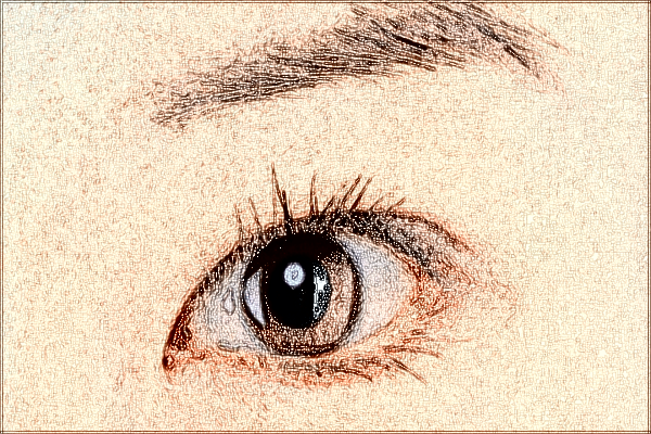 2024中山市人民醫(yī)院全飛秒手術(shù)多少錢?全飛秒手術(shù)恢復(fù)期