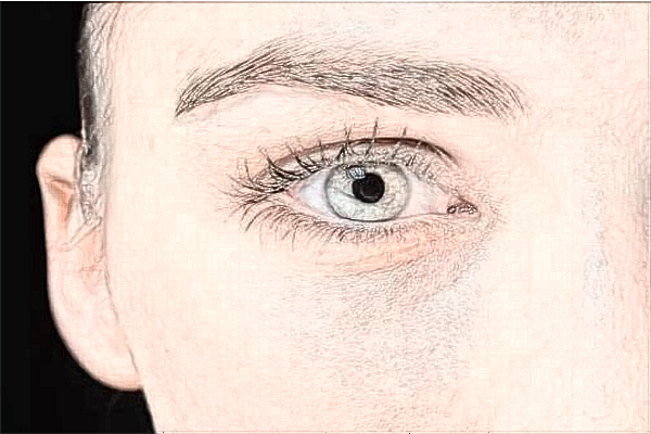 珠海市人民醫(yī)院做近視眼手術(shù)價(jià)格?近視眼手術(shù)恢復(fù)期多久