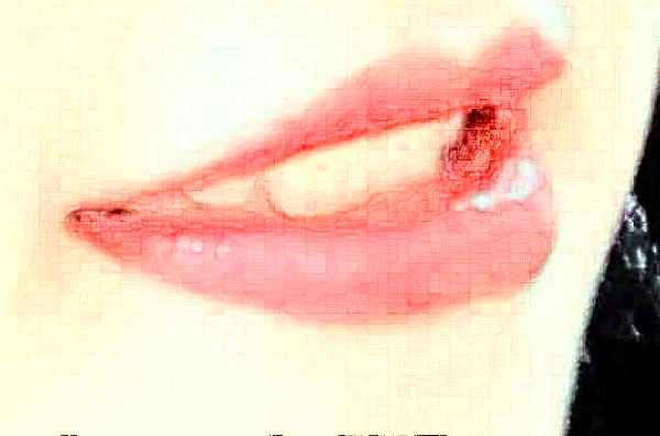 2024太原市中心醫(yī)院口腔科矯正牙齒怎么樣_哪個(gè)醫(yī)生比較好