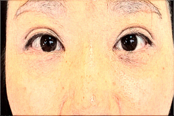 2024蘇州全切雙眼皮整形醫(yī)院排行榜前三！各大機(jī)構(gòu)哪家實(shí)力好？