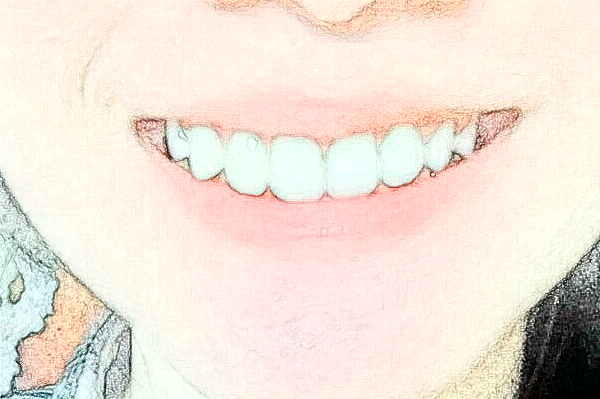 金華市中醫(yī)院口腔科牙齒修復(fù)做的好嗎？哪位醫(yī)生做的好