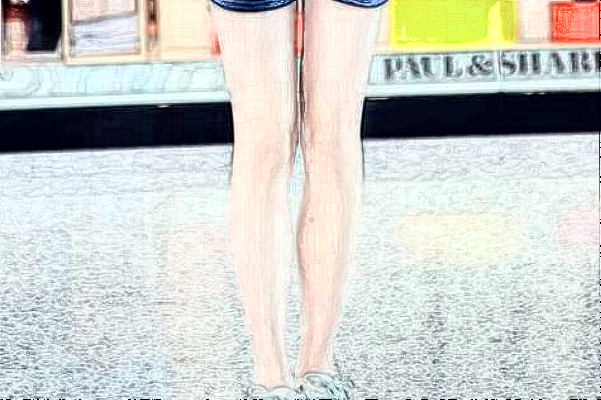 天津人民醫(yī)院激光脫毛怎么樣【激光脫毛案例分享】