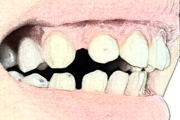 2024太原市中心醫(yī)院口腔科周辰醫(yī)生技術(shù)好不好_醫(yī)生簡(jiǎn)介