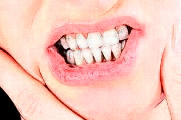 天津醫(yī)科大學(xué)第二醫(yī)院口腔科義齒修復(fù)價(jià)目表(價(jià)格表)怎么樣