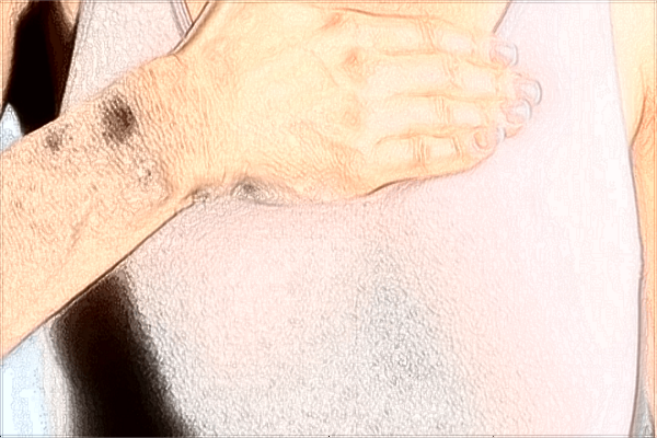 珠海市人民醫(yī)院整形外科怎么樣?整形外科包括哪些項(xiàng)目